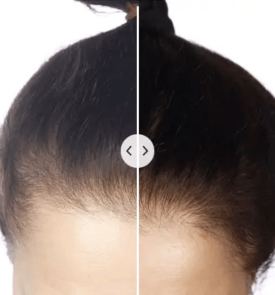 ChicBlend | Cepillo 5 en 1 | Terapia de Luz Roja y Azul | Masaje Capilar | Cuidado con Iones Negativos